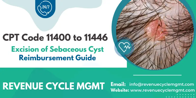 CPT Code 11400 To 11446 - Excision Of Sebaceous Cyst Reimbursement